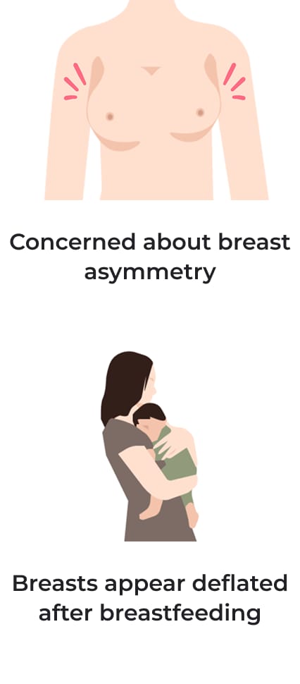 Concerned about breast asymmetry, breasts appear deflated after breastfeeding