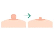 Nipple Reduction