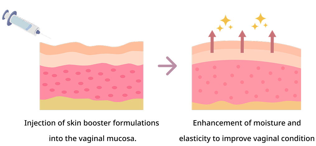 Procedure Method