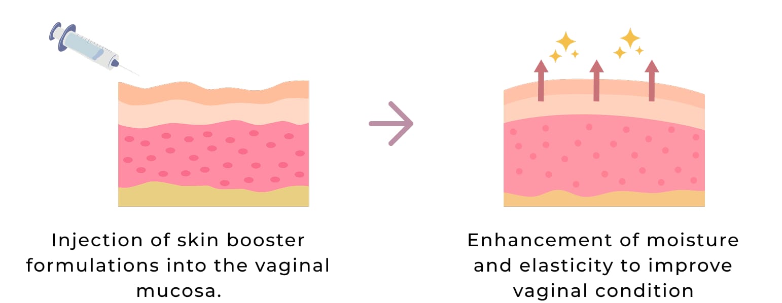 Procedure Method