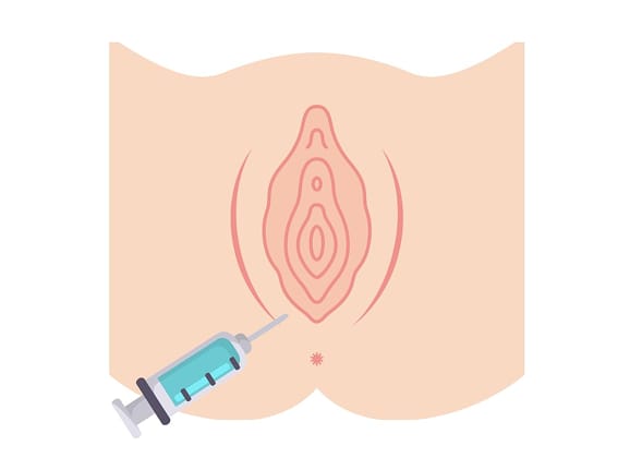What is Dyspareunia Botox?