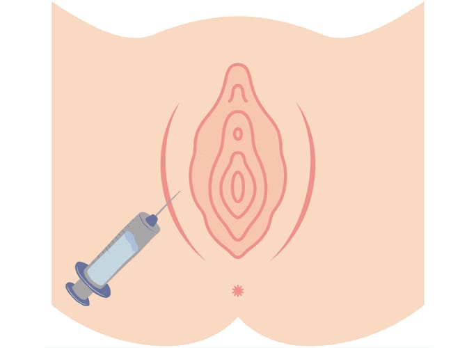 What is Labia Majora GOURI?