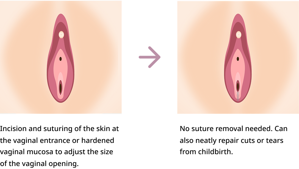 Procedure Method