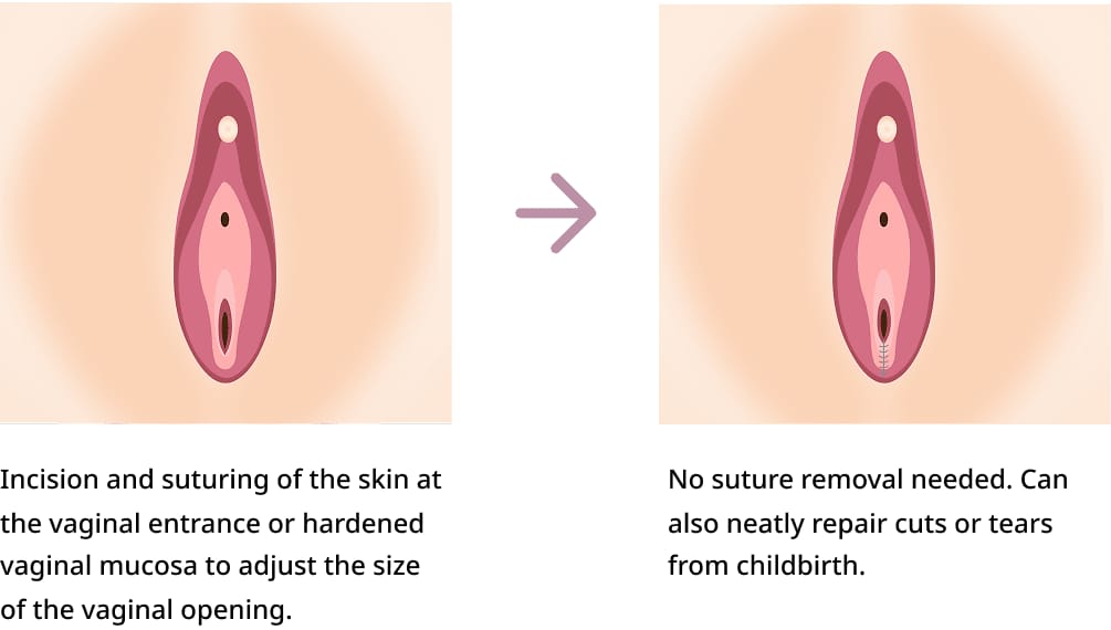 Procedure Method