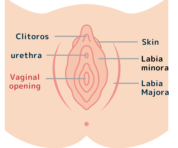 What is Vaginal Opening Reconstruction?