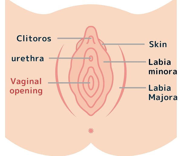 What is Vaginal Opening Reconstruction?