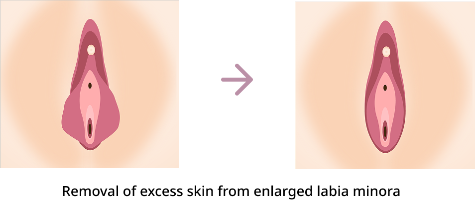 Procedure Method