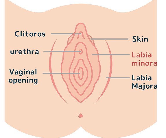 What is Labia Minora Reduction?
