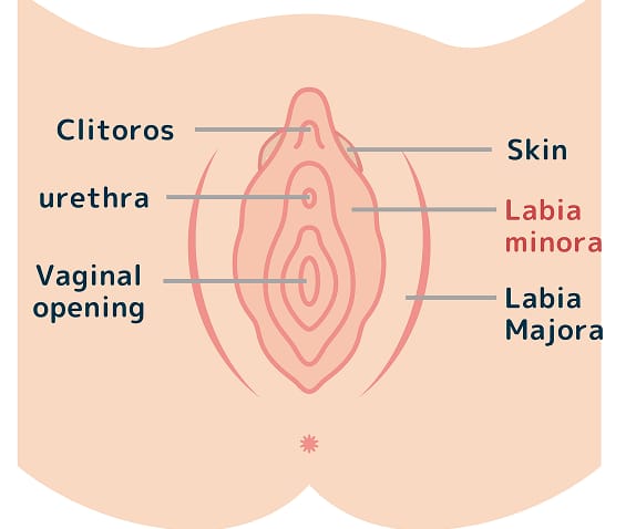 What is Labia Minora Reduction?