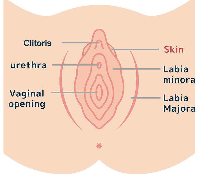 What is Hood Removal?