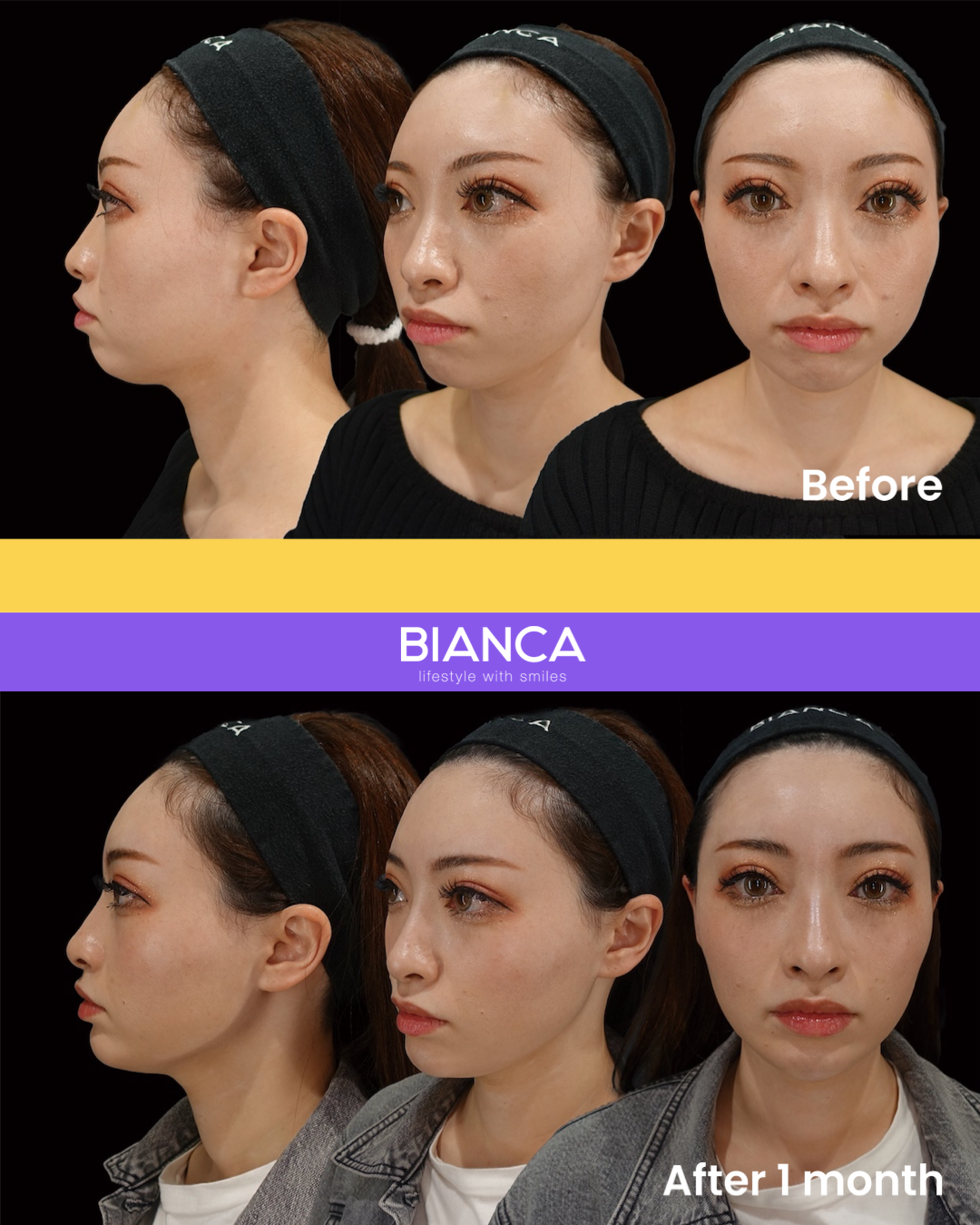 Blog post thumbnail