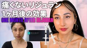 Blog post thumbnail