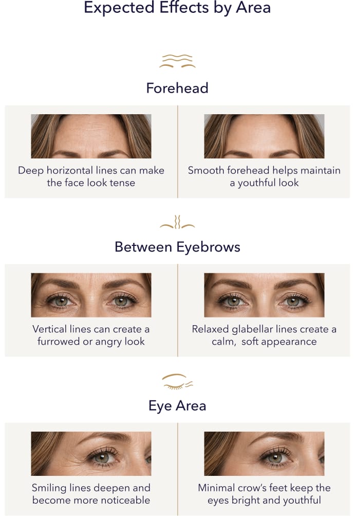 Comparison of smooth versus wrinkled appearance by forehead, brow, and eye area