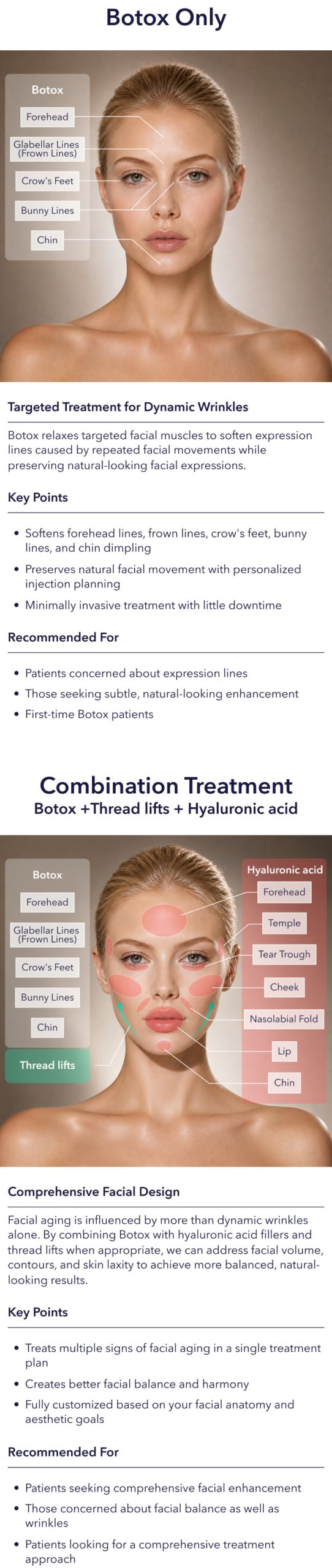 Facial diagram comparing Botox-only and combination treatment areas