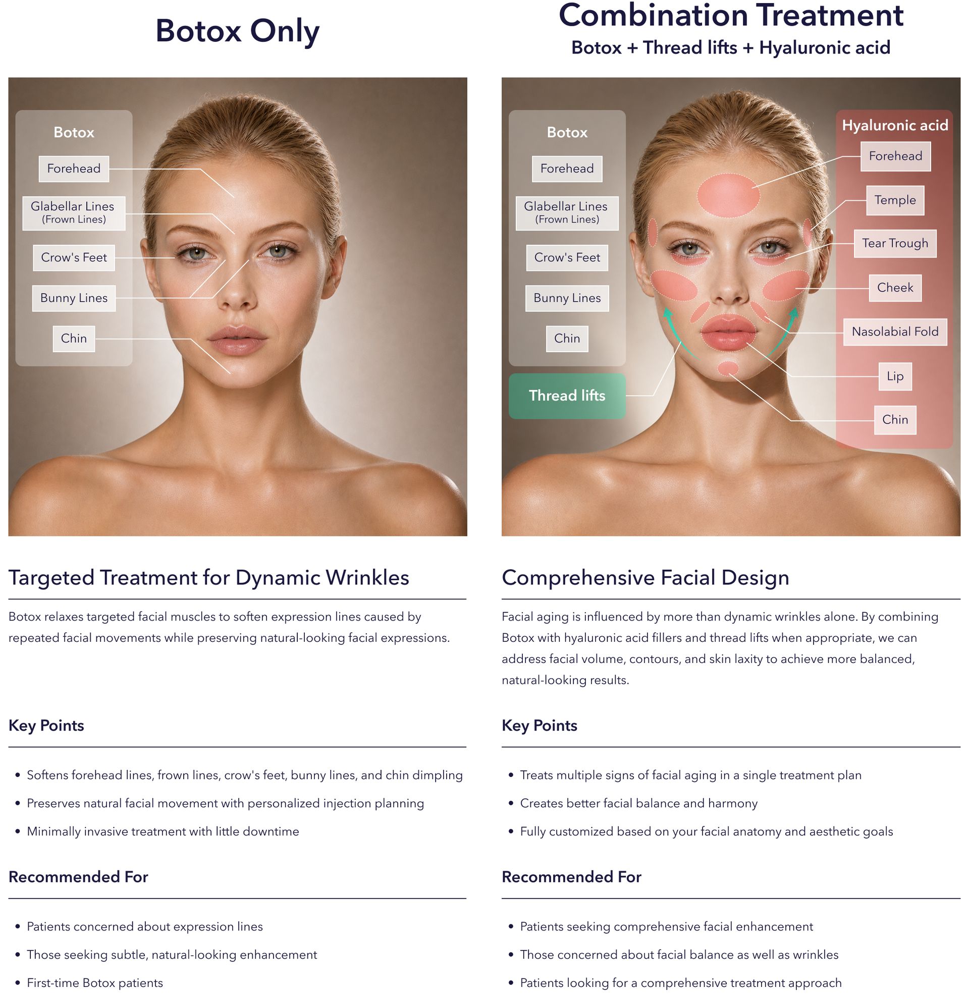 Facial diagram comparing Botox-only and combination treatment areas