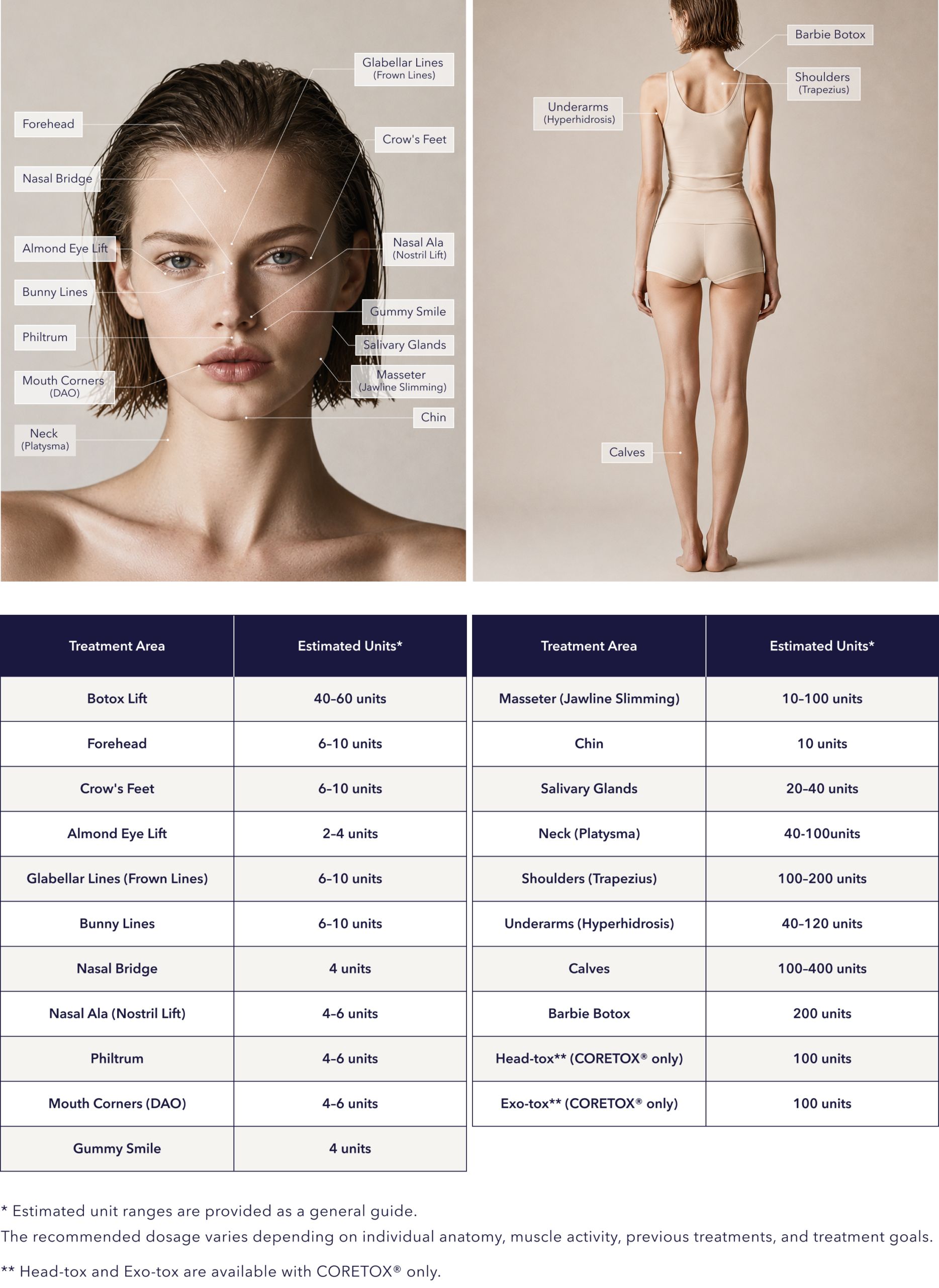 Labeled face and body diagram with Botox unit dosage chart by area