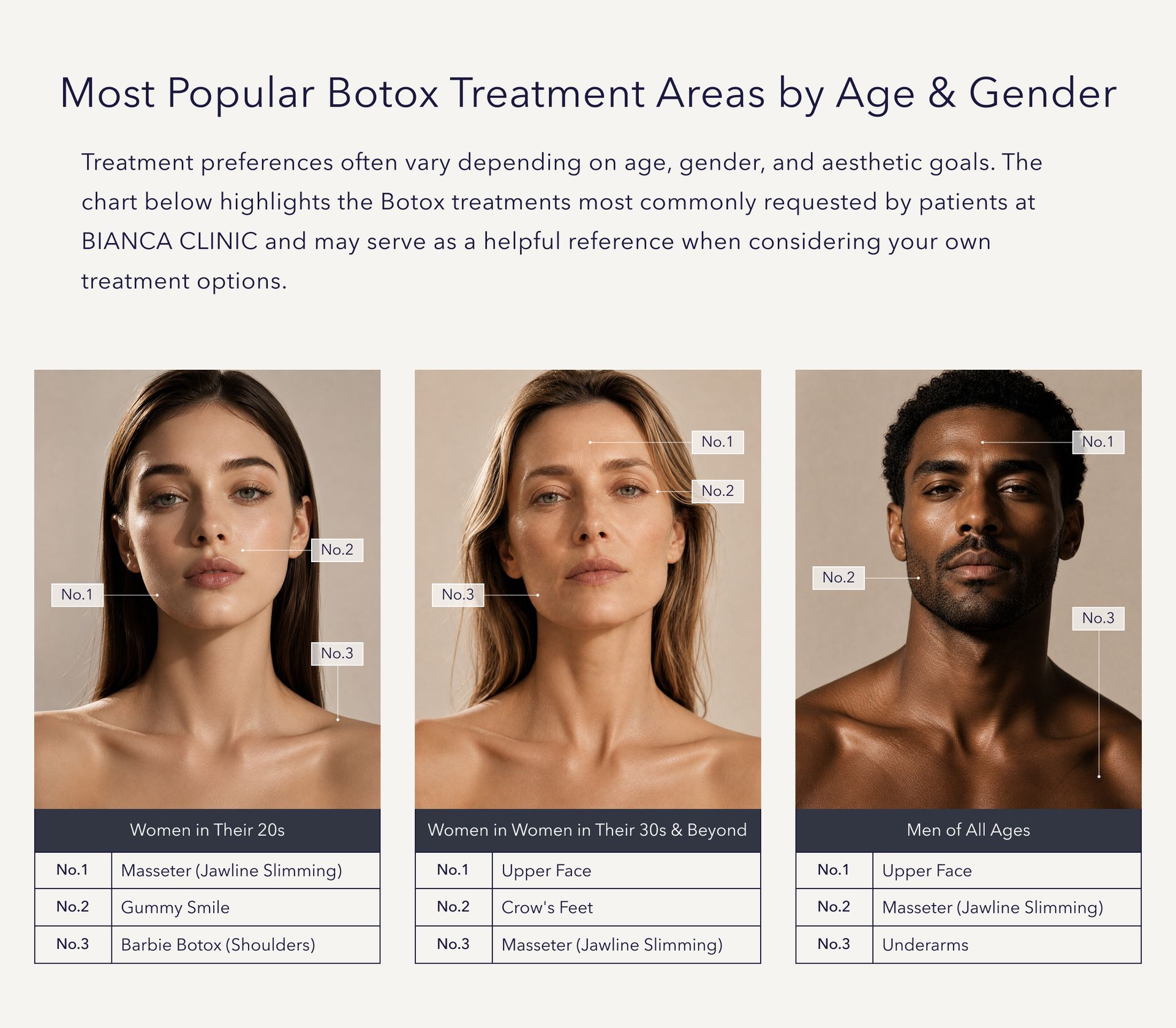 Ranked chart of popular Botox areas for women in their 20s, 30s and beyond, and men