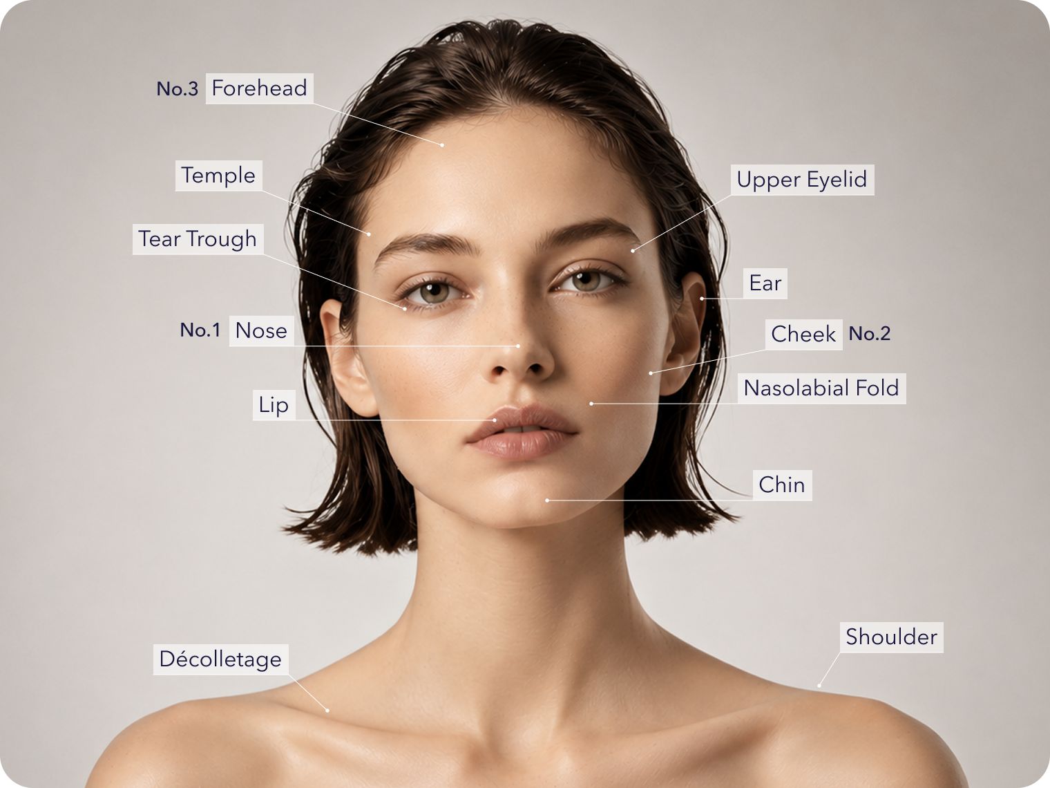 Facial filler treatment areas diagram: forehead, temple, cheek, chin, nasolabial fold, and more