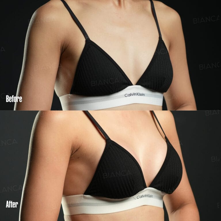 Surgery in Japanese? No Problem with BIANCA CLINIC’s Friendly Guide to Plastic Surgery in Tokyo