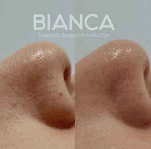 Facial Clinic Near Me with English-Speaking Medical Spa Care in Tokyo