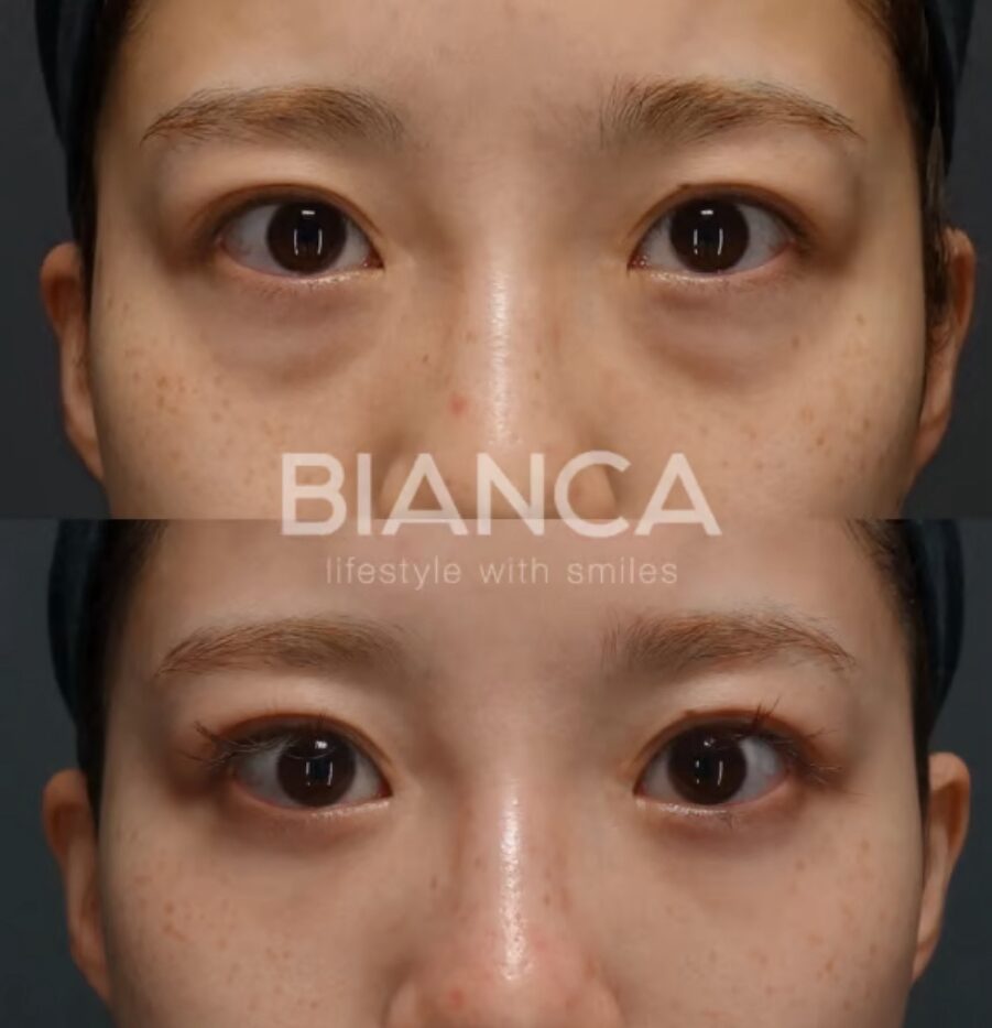 Condensed Rich Face