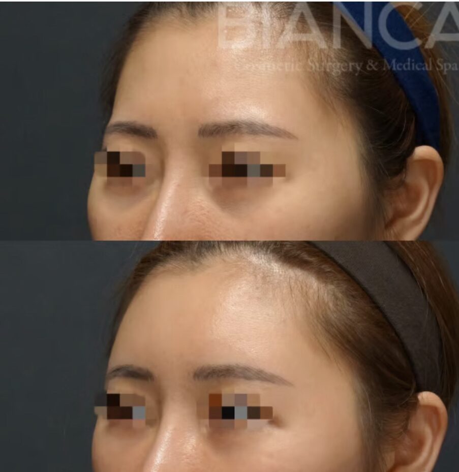 Condensed Rich Face