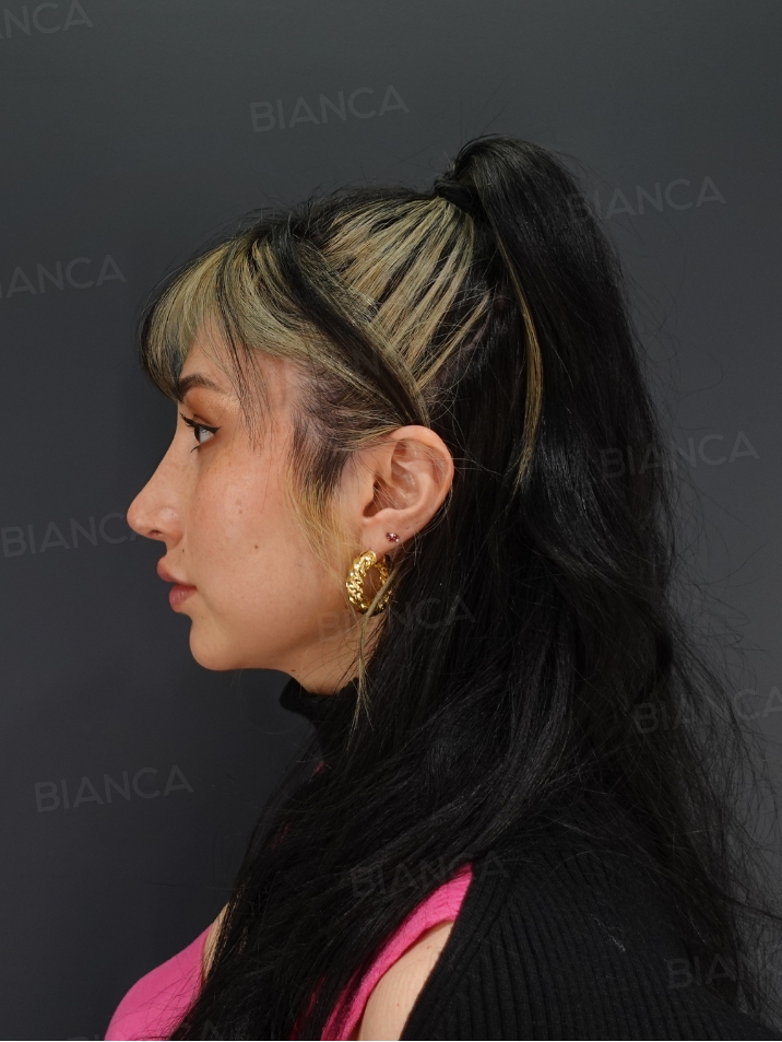 Side View After