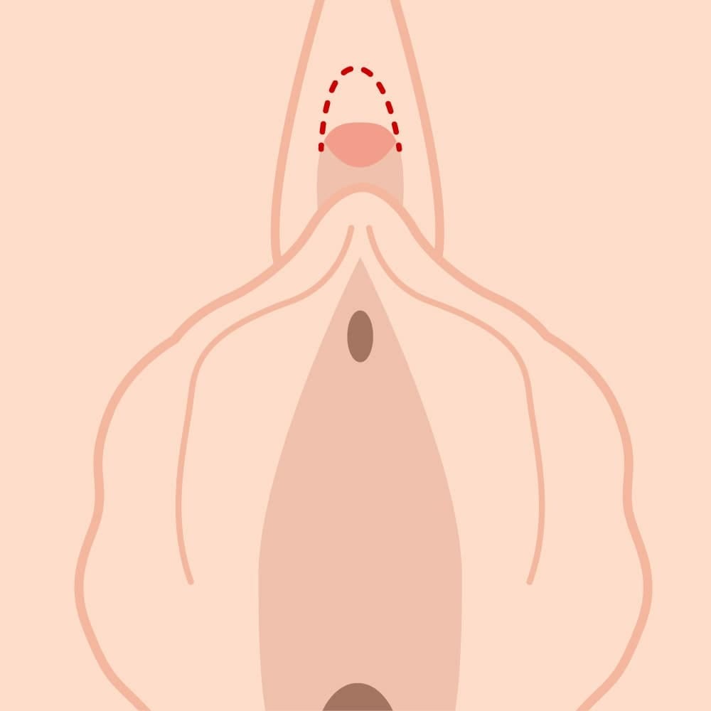 treatment_img