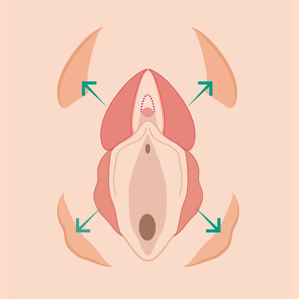 treatment_img