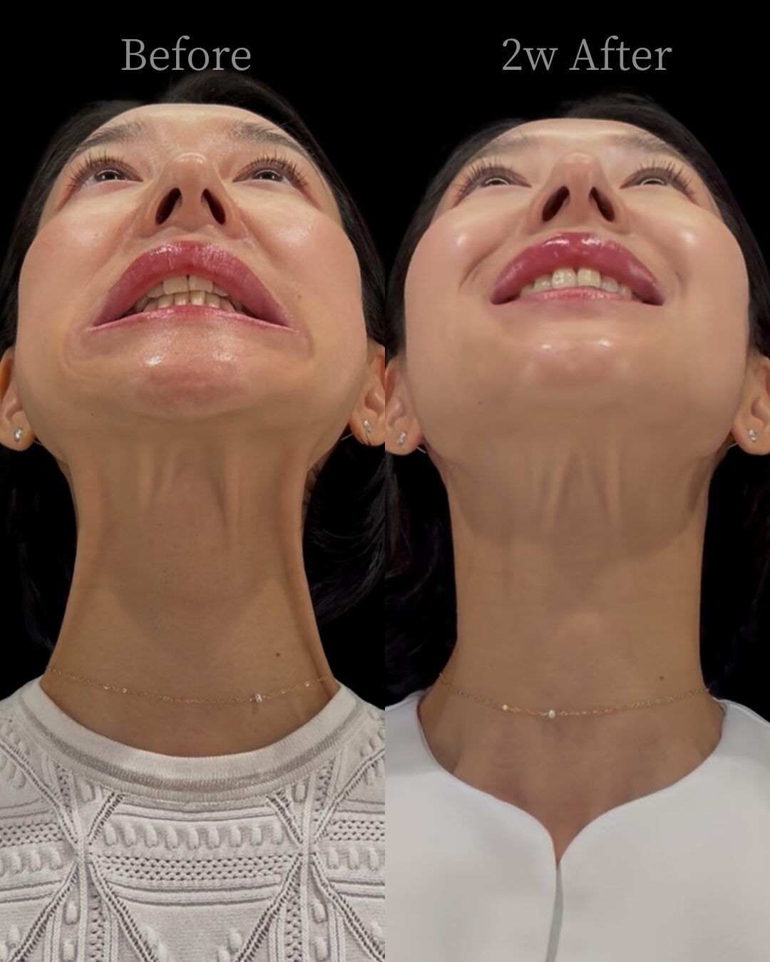 Longevity Examples with Proven Results at an Aesthetic Clinic in Tokyo