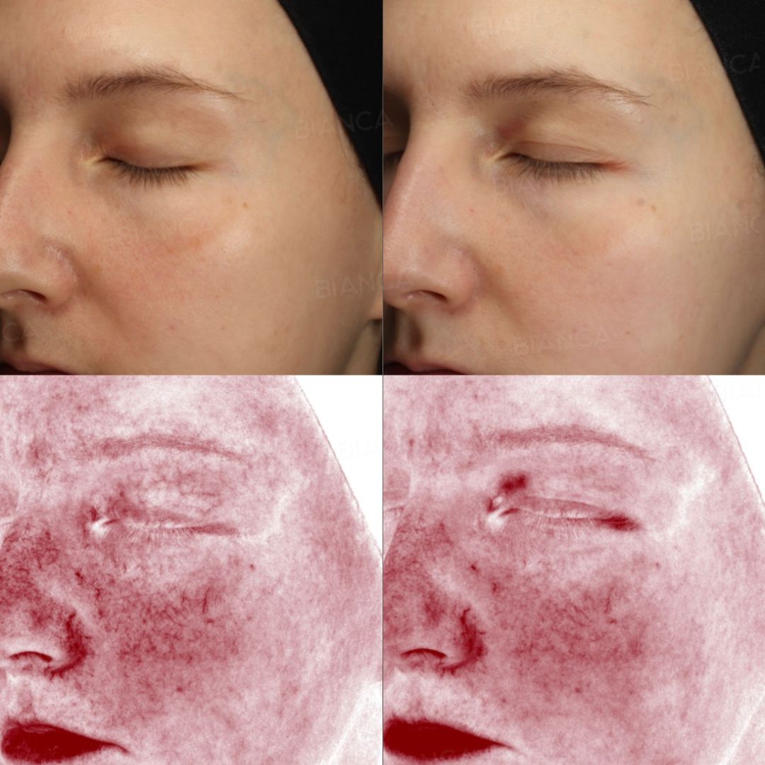 Medical Spa Laser Treatment in Tokyo: Hair Removal, Texture and Laxity Issues