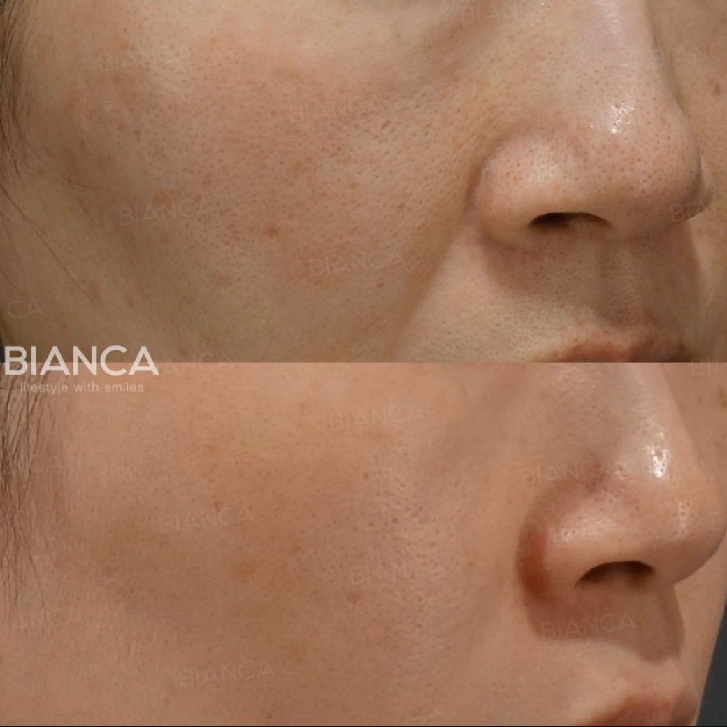 Medical Spa Facial: A Friendly Guide to Tokyo’s Aesthetic Industry