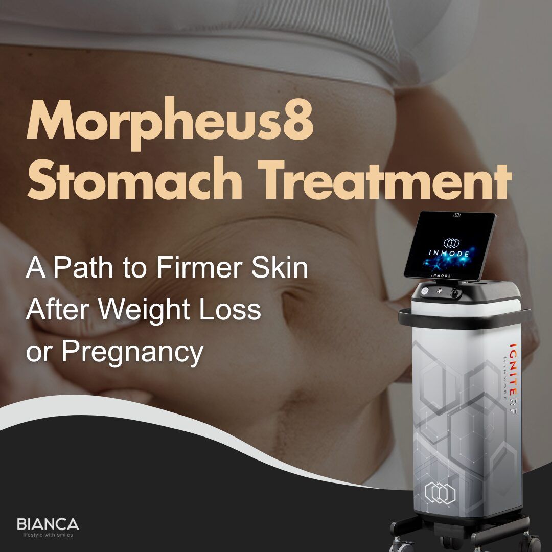 Remove Stretch Marks with Laser Treatment at A Medical Spa in Tokyo