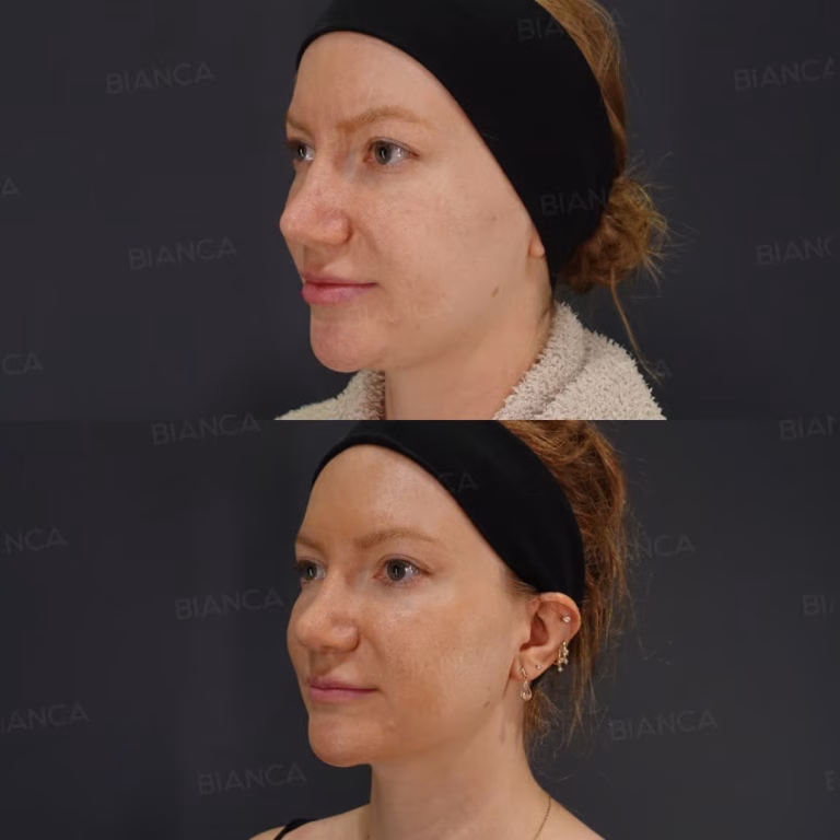 Cosmetic Surgery in Japan: Natural, English-Friendly Aesthetic Care in 2026