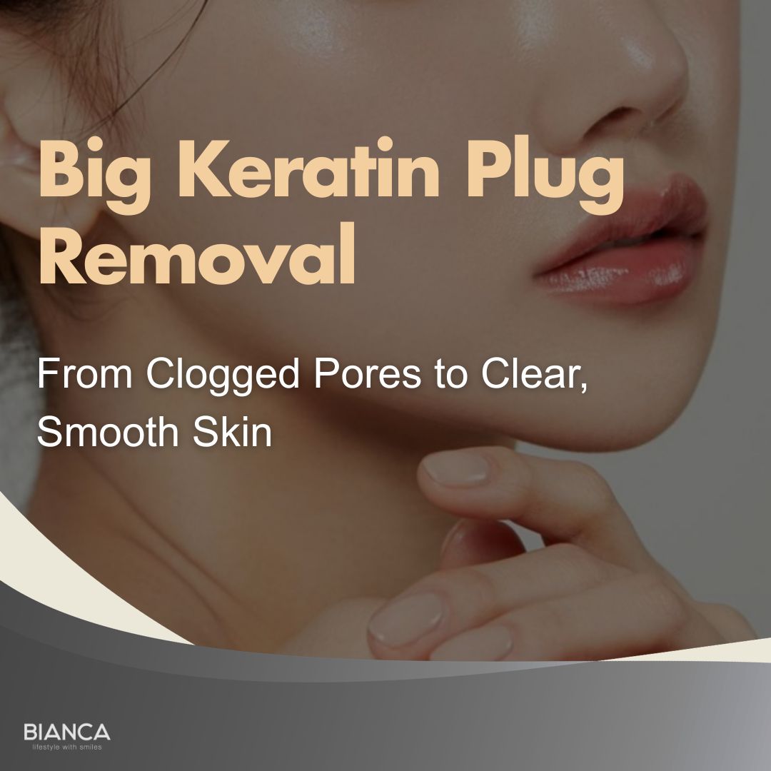 Big Keratin Plug Removal for clear, smooth skin.