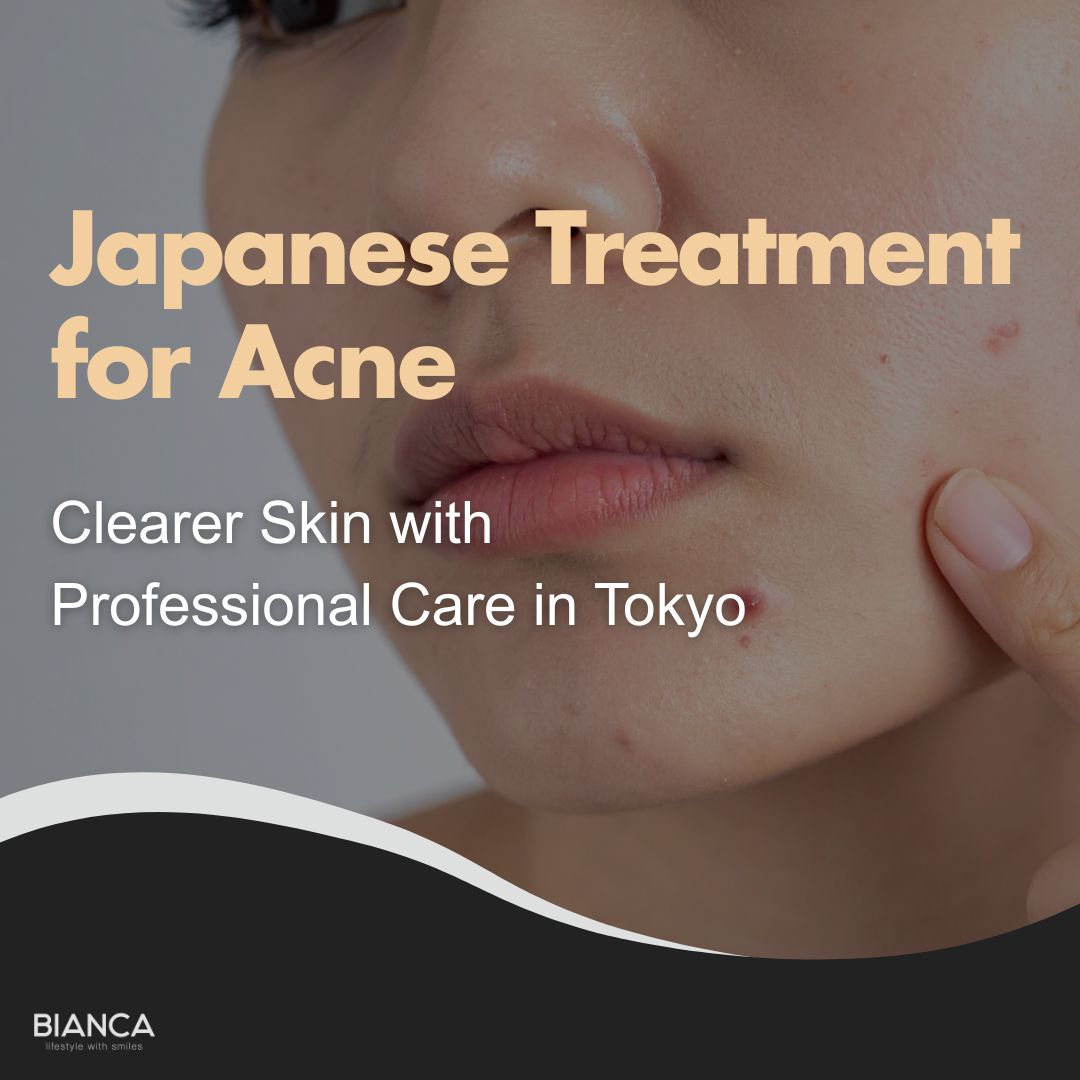 Japanese Treatment for Acne: Professional Care at BIANCA Clinic Tokyo
