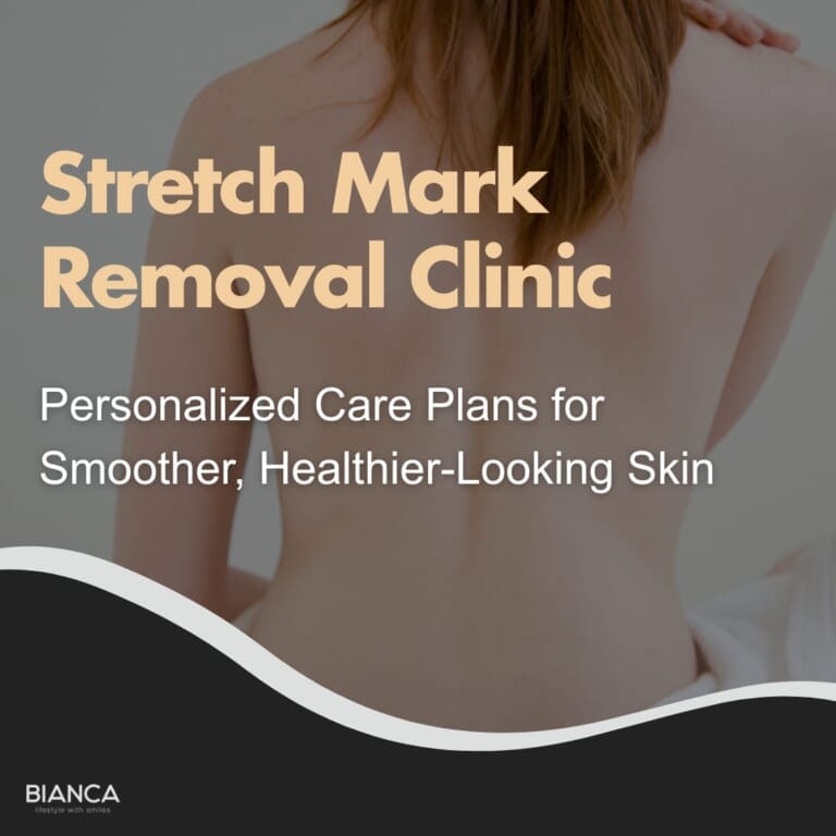 Main visual for a stretch mark removal clinic, promoting personalized care plans for smoother, healthier-looking skin.