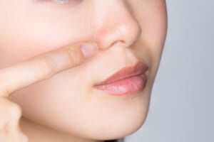 A woman pointing to clogged pores on her nose.