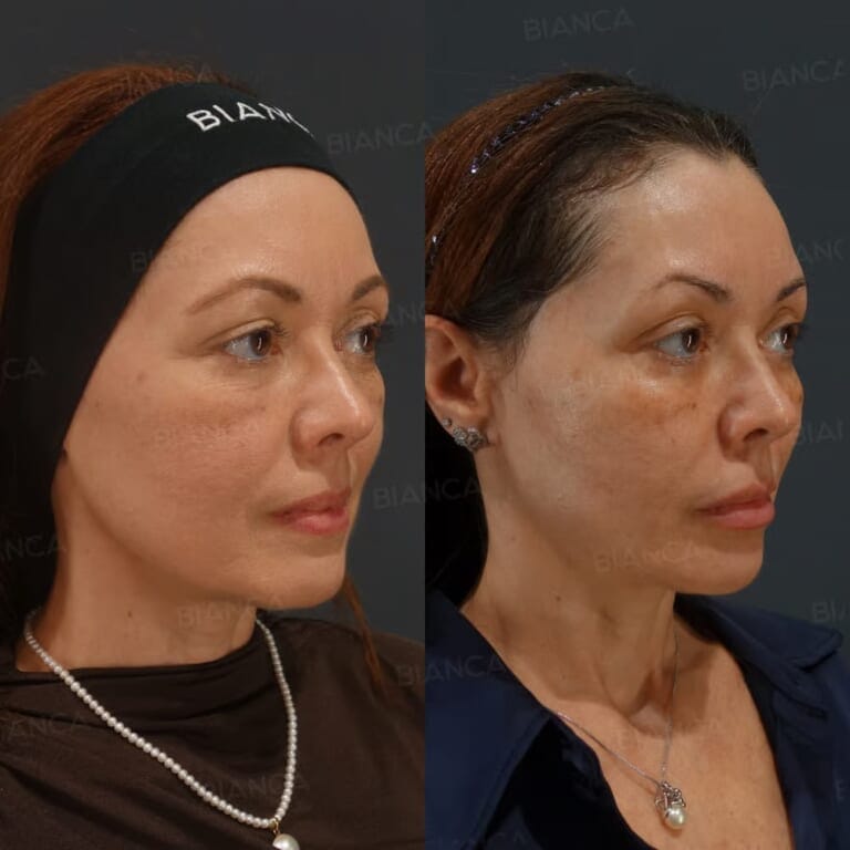 Plastic Surgery Clinics in Tokyo: English-Speaking Guidance and Cosmetic Surgery Care