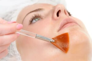 Manuka Peel treatment at BIANCA CLINIC.