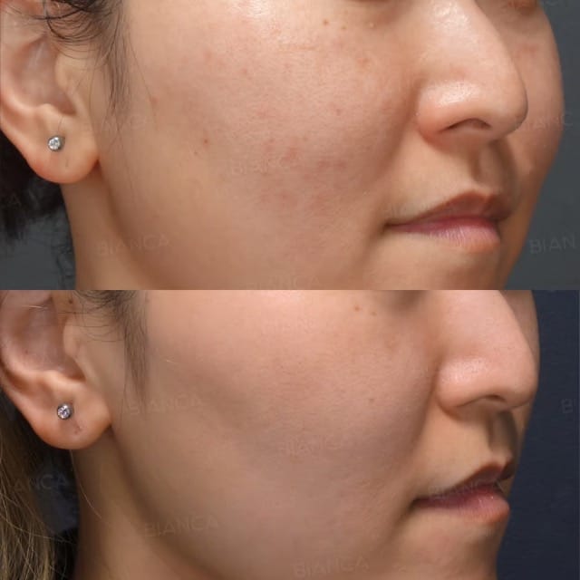 Glass Skin Care in Tokyo: Your Friendly Guide to Medical Spa Treatments at BIANCA CLINIC