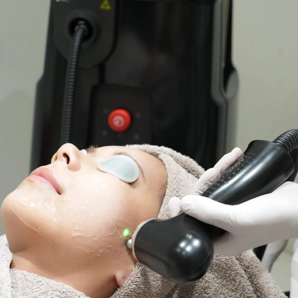 ADVATX LASER