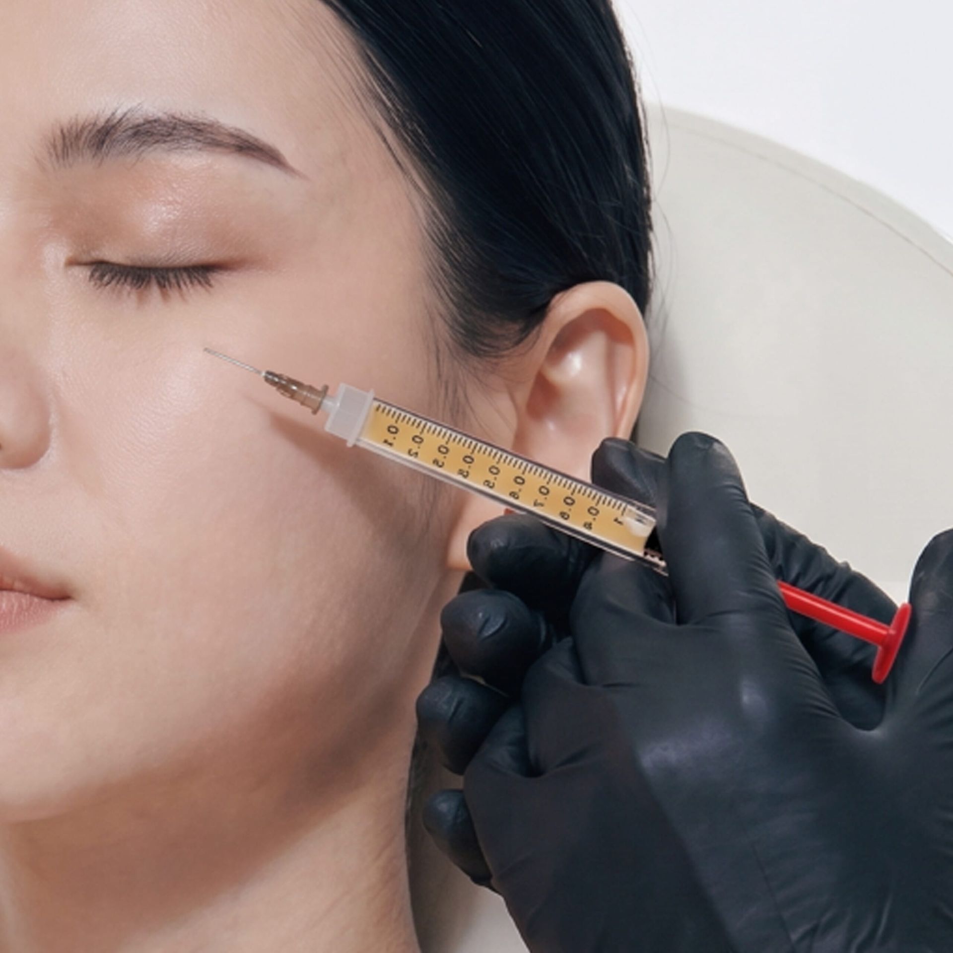 Professional ezGEL injection procedure at BIANCA CLINIC for facial rejuvenation.