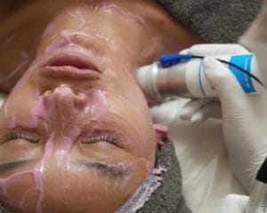 Mesona J treatment procedure