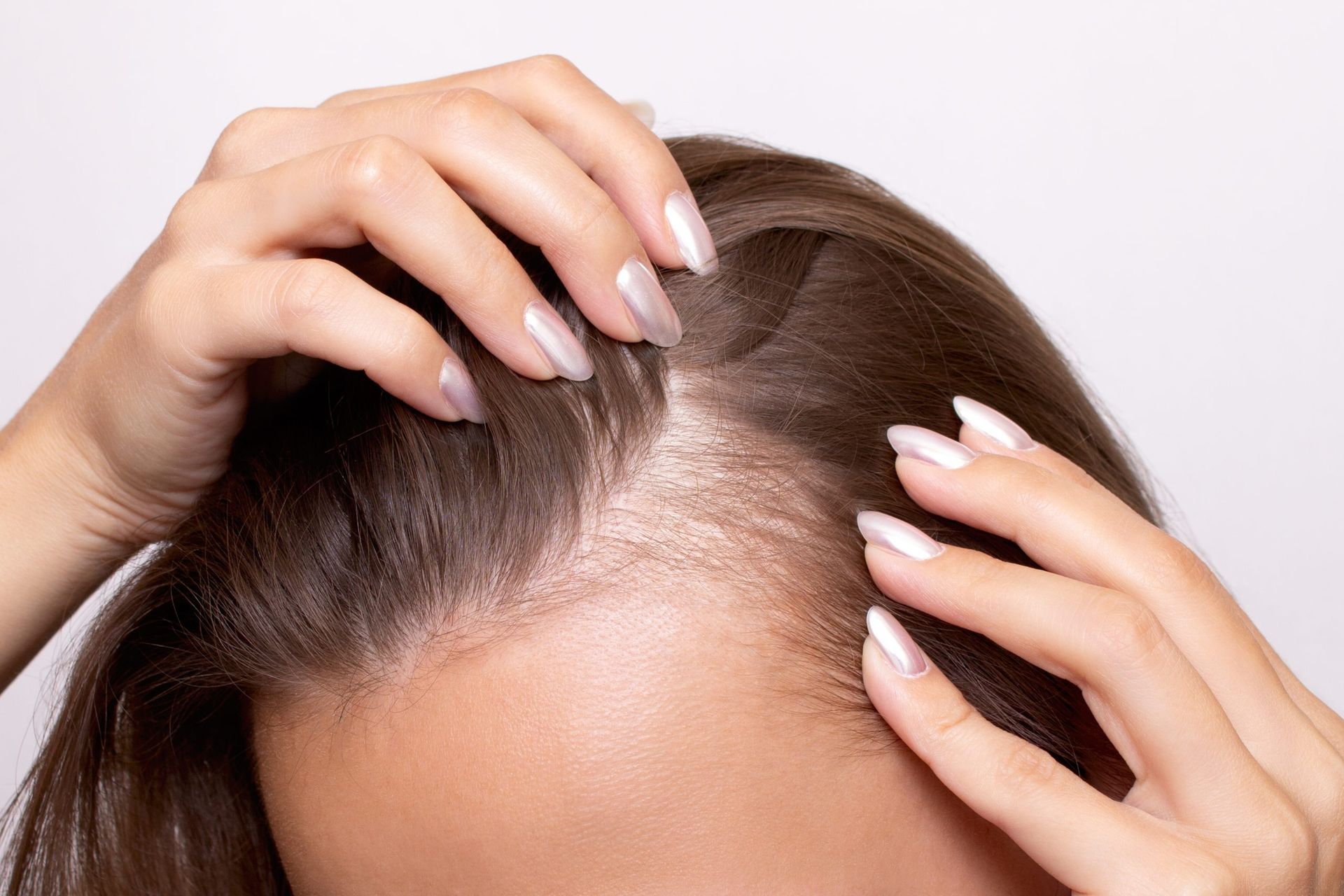 Thinning-hair