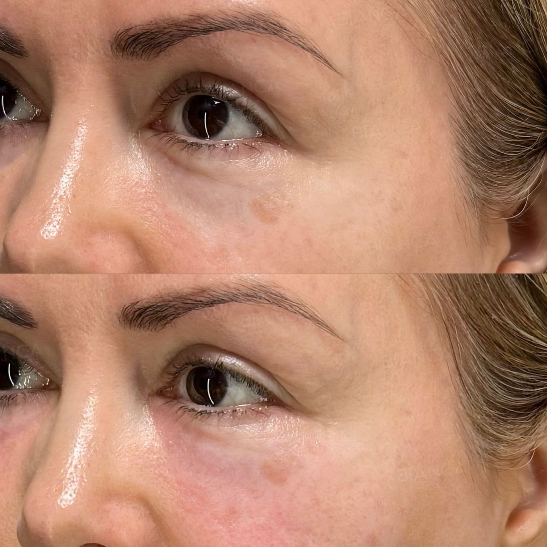 Baby Collagen (Under Eyes)