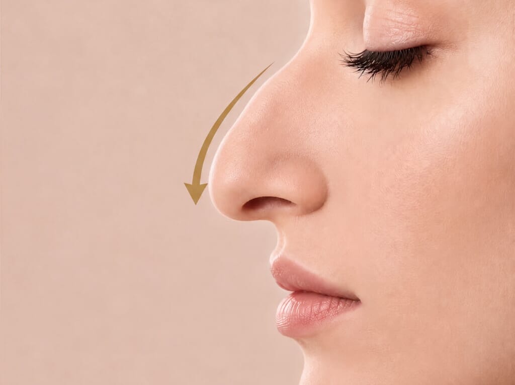 Side profile of a woman's nose with a gold line highlighting the nasal tip for tip refinement surgery.