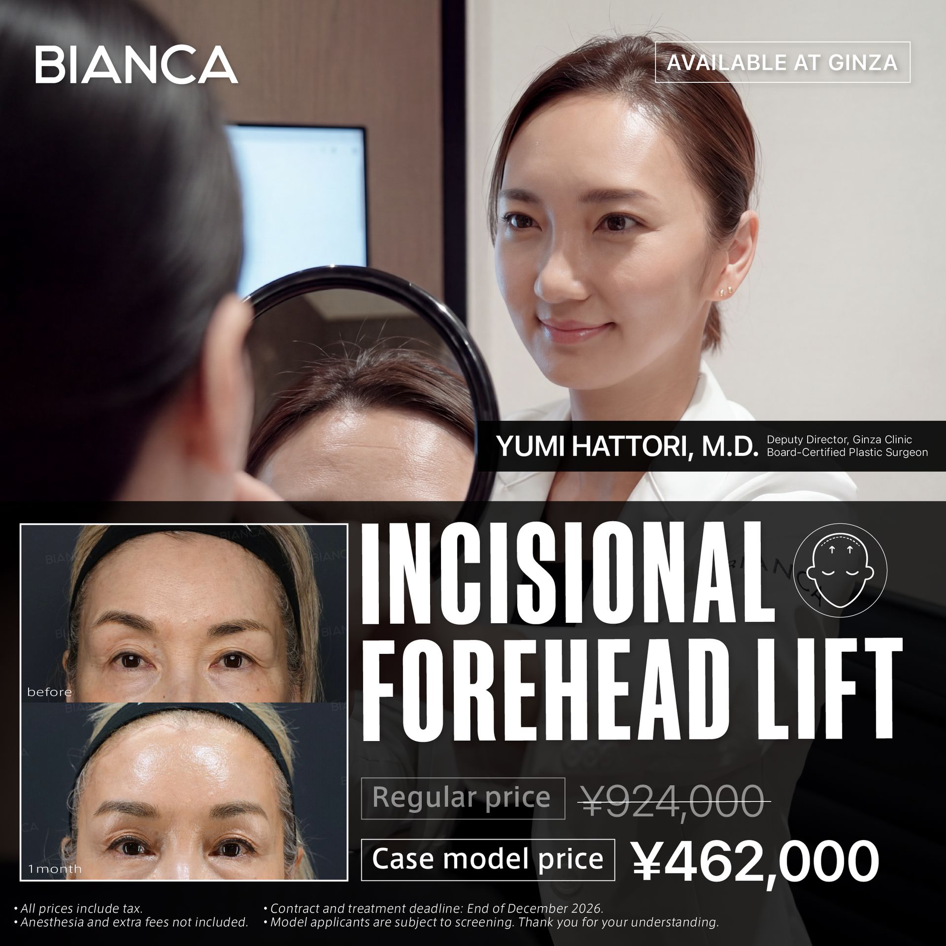 【Ginza Clinic · Dr. Hattori Exclusive】Surgical Forehead Lift
