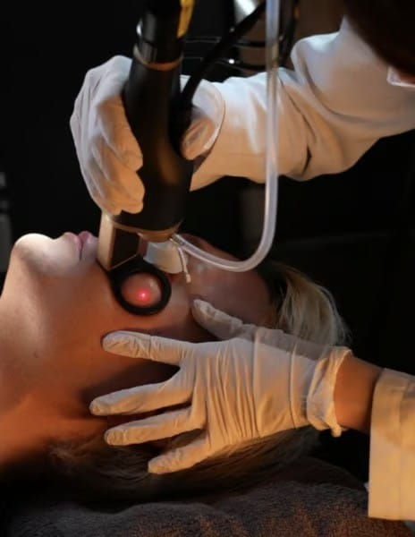 Laser Treatment