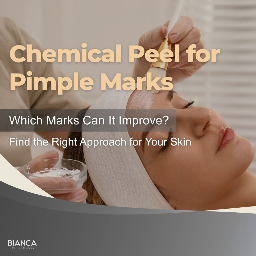 Chemical peel for pimple marks: treatment options and expected results